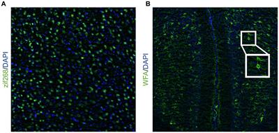 Generalization and discrimination of inhibitory avoidance differentially engage anterior and posterior retrosplenial subregions